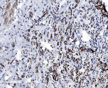 VDAC3 Rabbit Polyclonal Antibody