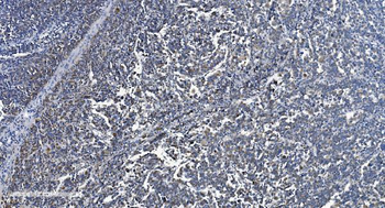 VDAC3 Rabbit Polyclonal Antibody