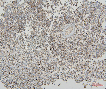 VDAC3 Rabbit Polyclonal Antibody