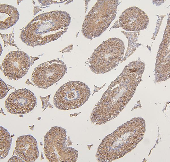 VDAC3 Rabbit Polyclonal Antibody