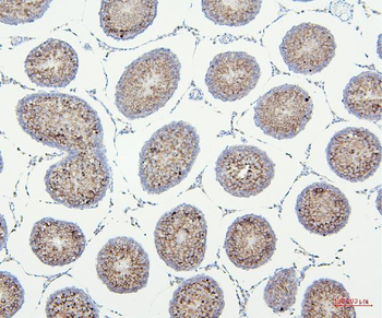 VDAC3 Rabbit Polyclonal Antibody