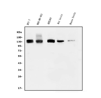 KIBRA/WWC1 Rabbit Polyclonal Antibody