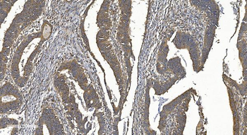 YTHDF2 Rabbit Polyclonal Antibody