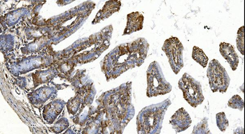 YTHDF2 Rabbit Polyclonal Antibody