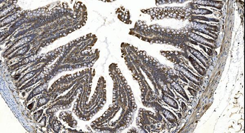 YTHDF2 Rabbit Polyclonal Antibody