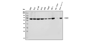 YTHDF2 Rabbit Polyclonal Antibody