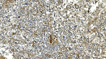 Carbonic Anhydrase 13/CA13 Rabbit Polyclonal Antibody