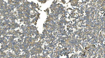 Carbonic Anhydrase 13/CA13 Rabbit Polyclonal Antibody