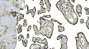 Carbonic Anhydrase 13/CA13 Rabbit Polyclonal Antibody