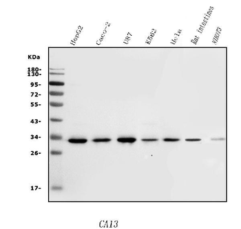 Carbonic Anhydrase 13/CA13 Rabbit Polyclonal Antibody