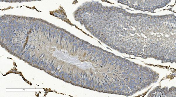 COX8A Rabbit Polyclonal Antibody