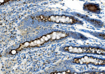 Golm1/GOLPH2 Rabbit Polyclonal Antibody