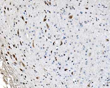 GRX2/GLRX2 Rabbit Polyclonal Antibody