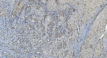 GRX2/GLRX2 Rabbit Polyclonal Antibody