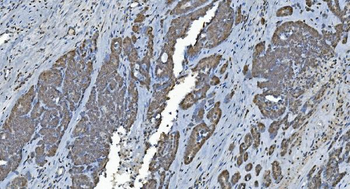 GRX2/GLRX2 Rabbit Polyclonal Antibody