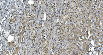 GRX2/GLRX2 Rabbit Polyclonal Antibody