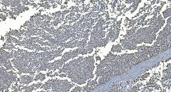 GRX2/GLRX2 Rabbit Polyclonal Antibody