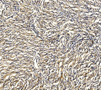 GRID2 Rabbit Polyclonal Antibody