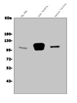 GRID2 Rabbit Polyclonal Antibody