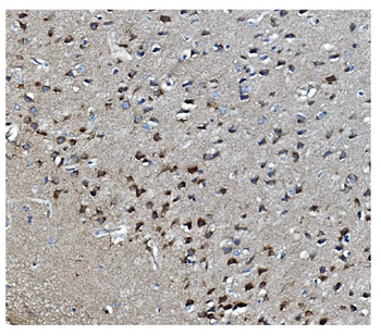 MAPK11 Antibody