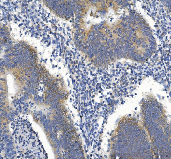 GDF8/Myostatin/MSTN Rabbit Polyclonal Antibody