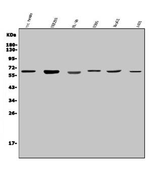 PARP2 Rabbit Polyclonal Antibody