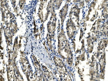 Sorbitol Dehydrogenase/SORD Rabbit Polyclonal Antibody