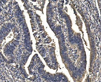 Sorbitol Dehydrogenase/SORD Rabbit Polyclonal Antibody