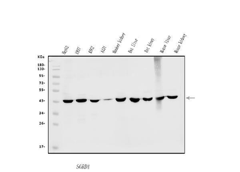 Sorbitol Dehydrogenase/SORD Rabbit Polyclonal Antibody