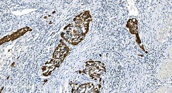 Glycine decarboxylase/GLDC Rabbit Polyclonal Antibody