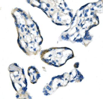 Glycine decarboxylase/GLDC Rabbit Polyclonal Antibody