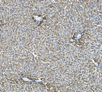 Glycine decarboxylase/GLDC Rabbit Polyclonal Antibody