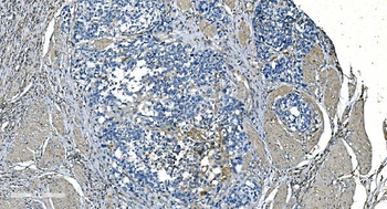 GNG2 Rabbit Polyclonal Antibody