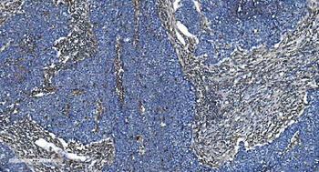 GNG2 Rabbit Polyclonal Antibody