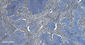 GNG2 Rabbit Polyclonal Antibody