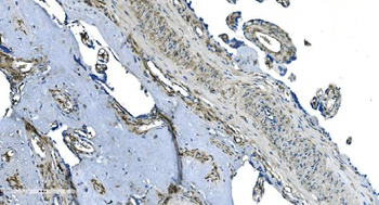 GNG2 Rabbit Polyclonal Antibody