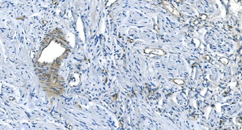 GNG2 Rabbit Polyclonal Antibody