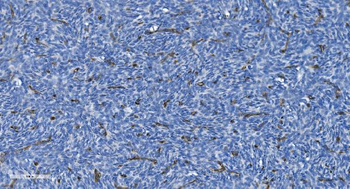 GNG11 Rabbit Polyclonal Antibody