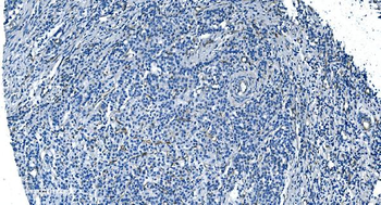 GNG11 Rabbit Polyclonal Antibody