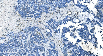 GNG11 Rabbit Polyclonal Antibody