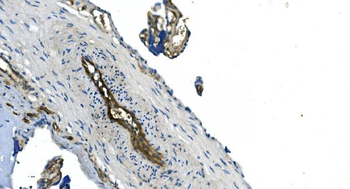GNG11 Rabbit Polyclonal Antibody