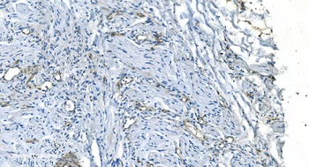 GNG11 Rabbit Polyclonal Antibody