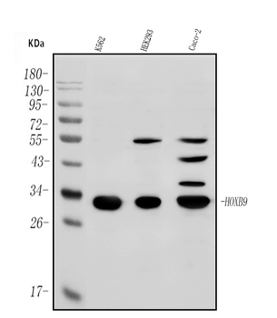 HOXB9 Rabbit Polyclonal Antibody