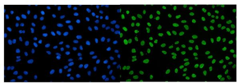 IGF2-AS/IGF2 Rabbit Polyclonal Antibody