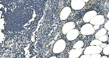 LSM8 Antibody