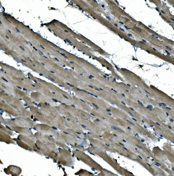 NDUFB5 Antibody