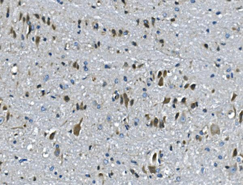PAR4/Pawr Rabbit Polyclonal Antibody