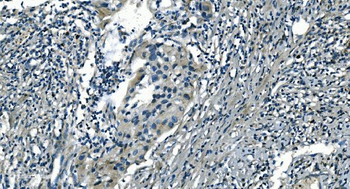 PI-16/PI16/PI Rabbit Polyclonal Antibody