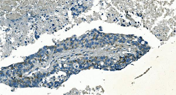 PI-16/PI16/PI Rabbit Polyclonal Antibody