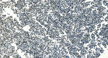 PI-16/PI16/PI Rabbit Polyclonal Antibody